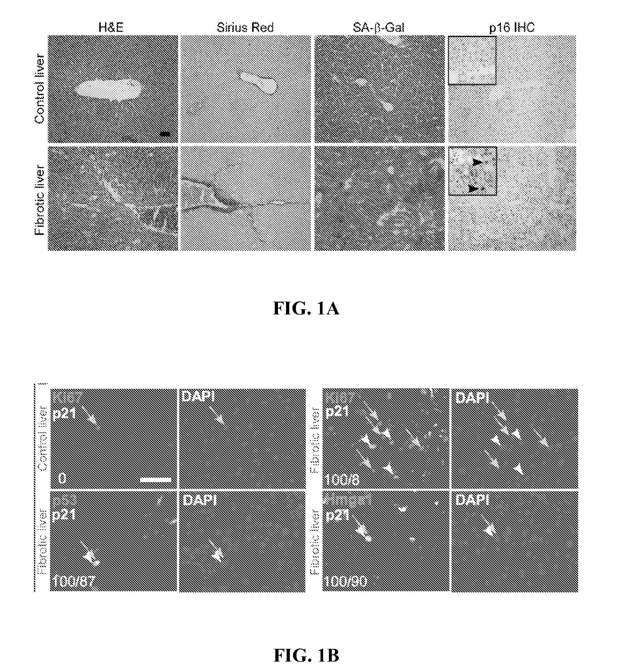 Methods for treating fibrosis by modulating cellular senescence