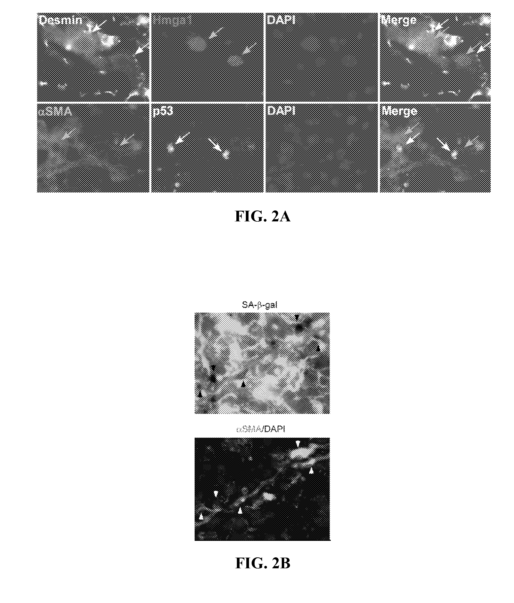 Methods for treating fibrosis by modulating cellular senescence