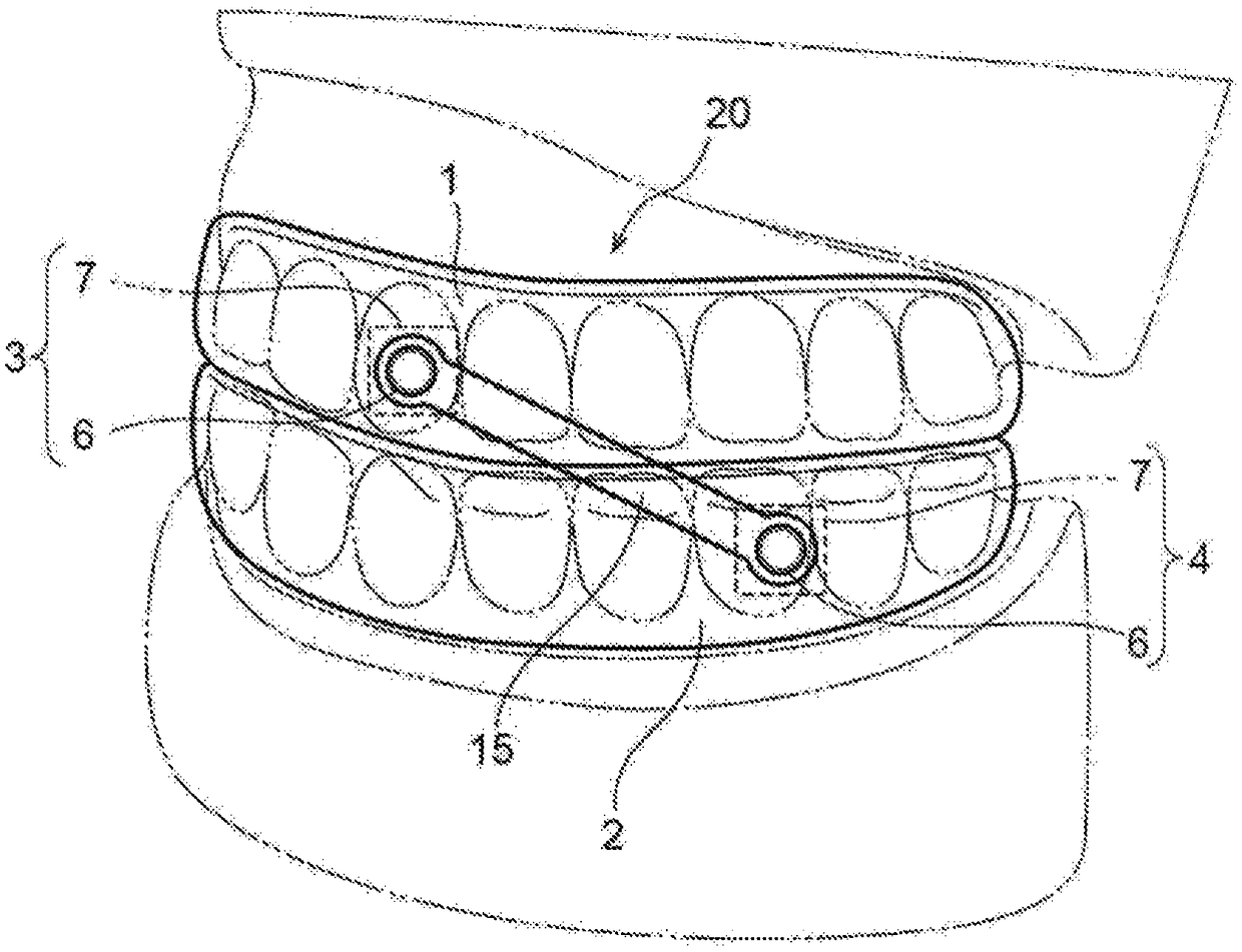 Mouthpiece, sheet for producing piece part of mouthpiece, and method for producing mouthpiece
