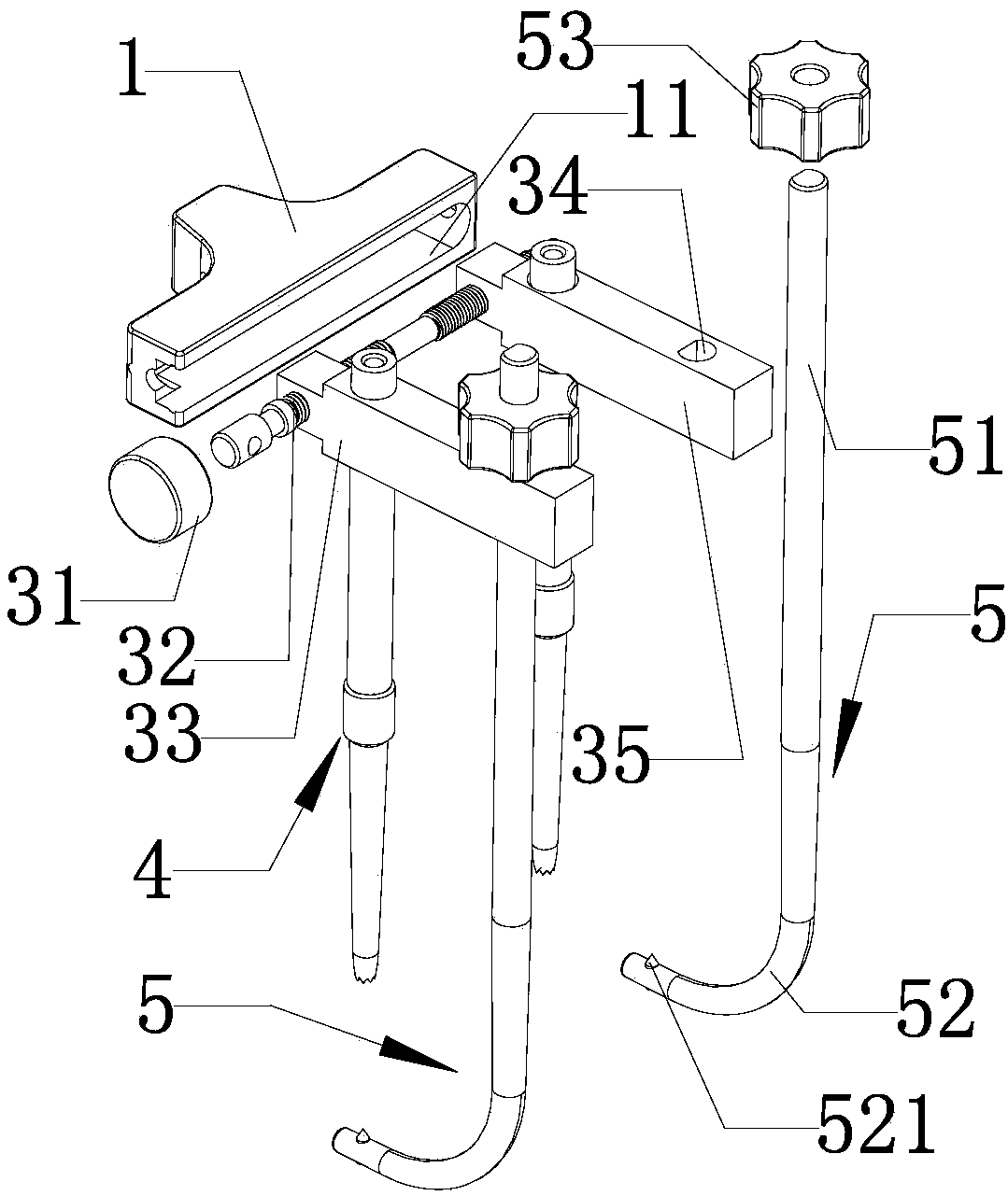 Adjustable fracture minimally invasive compression fixation guiding device and use method thereof