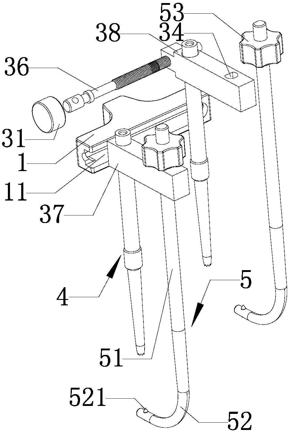 Adjustable fracture minimally invasive compression fixation guiding device and use method thereof