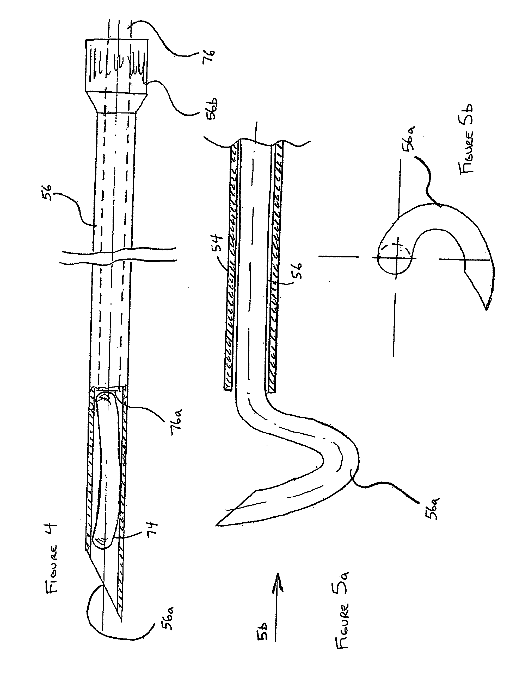 Catheter-based tissue remodeling devices and methods