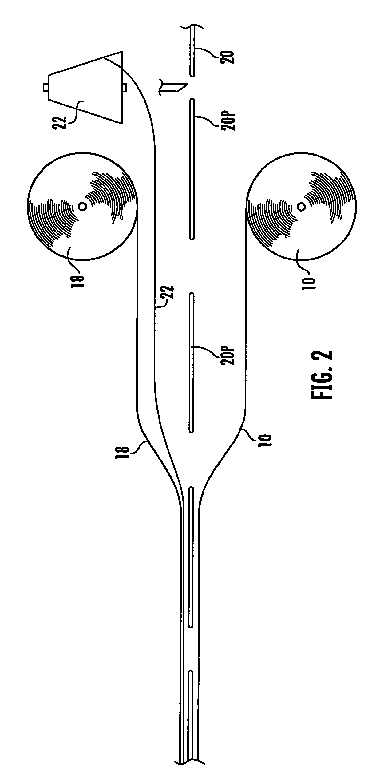 Method of making oversized adult incontinence diapers exceeding overall width capacity of converting machinery and diaper formed thereby