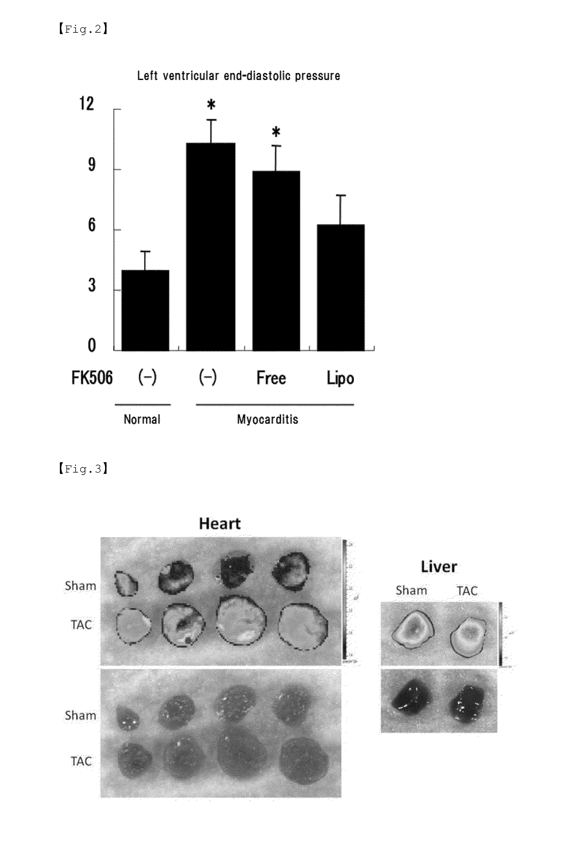 Pharmaceutical composition for treating inflammatory disease