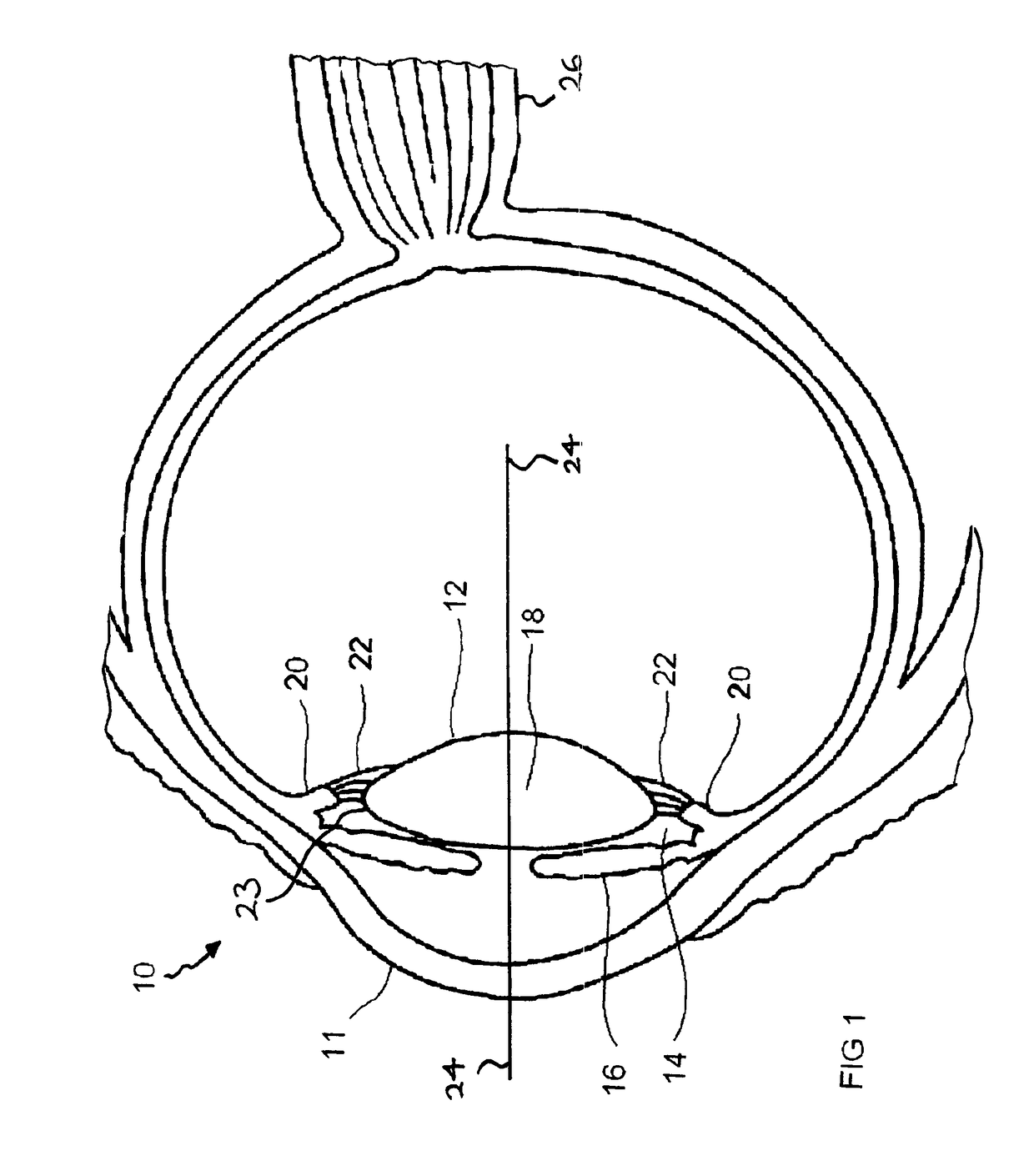 Accommodating intraocular lens systems and intraocular lens focusers