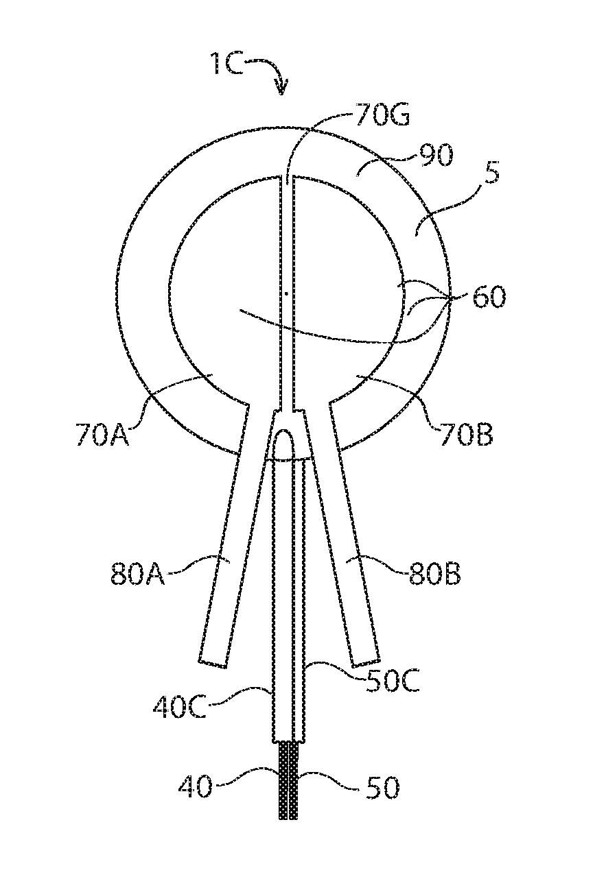 Force sensing resistor with external conductive layer