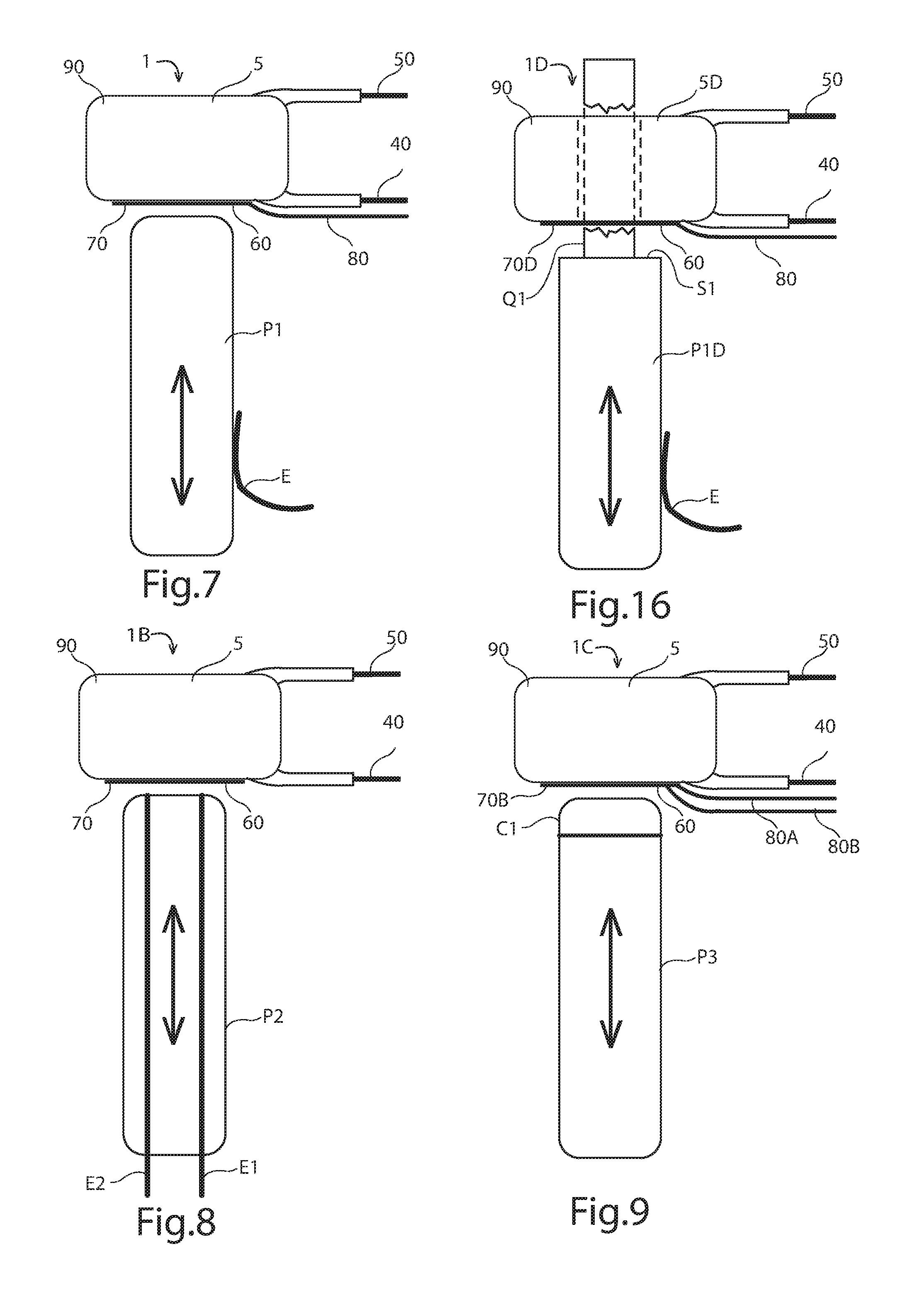 Force sensing resistor with external conductive layer