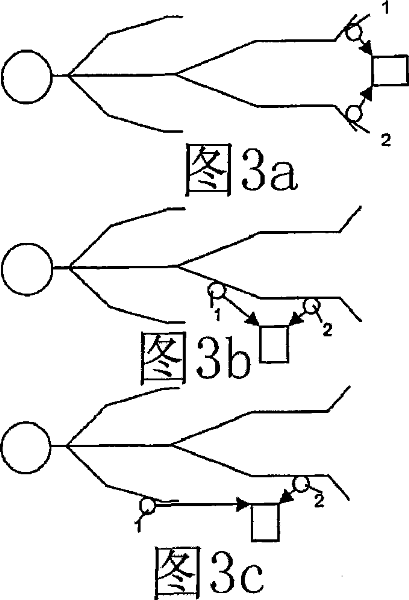 DVT detection