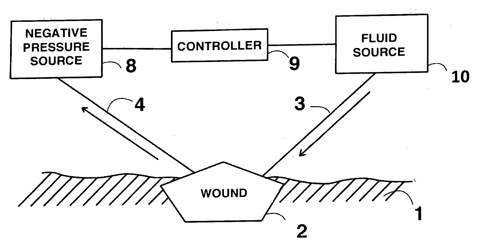 Method for dressing a wound