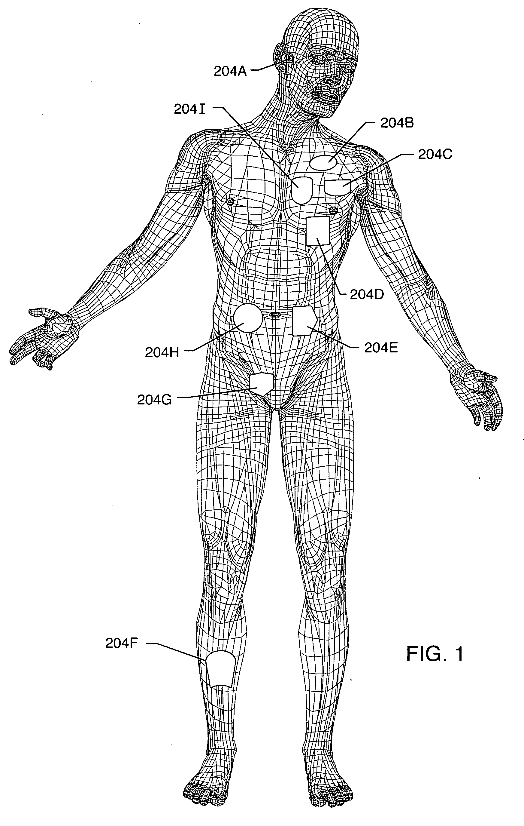 Apparatus and process for reducing the susceptability of active implantable medical devices to medical procedures such as magnetic resonance imaging