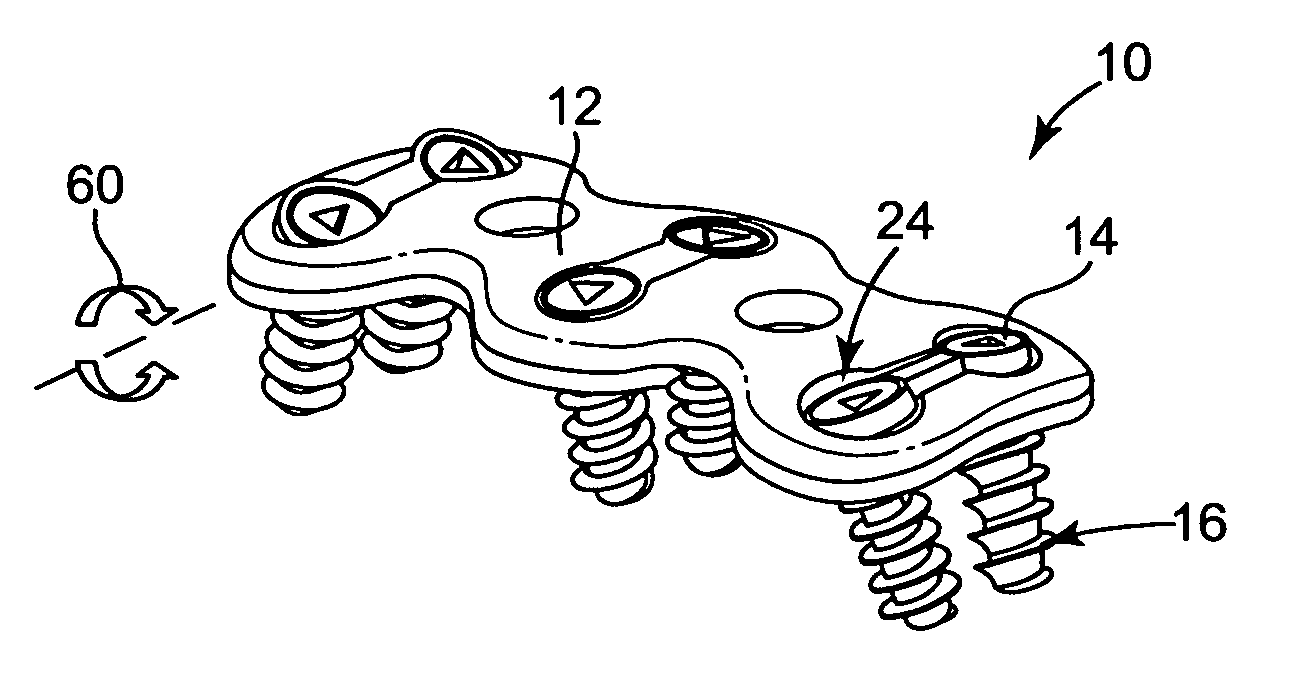 Cervical plate system having an insertable rotating element