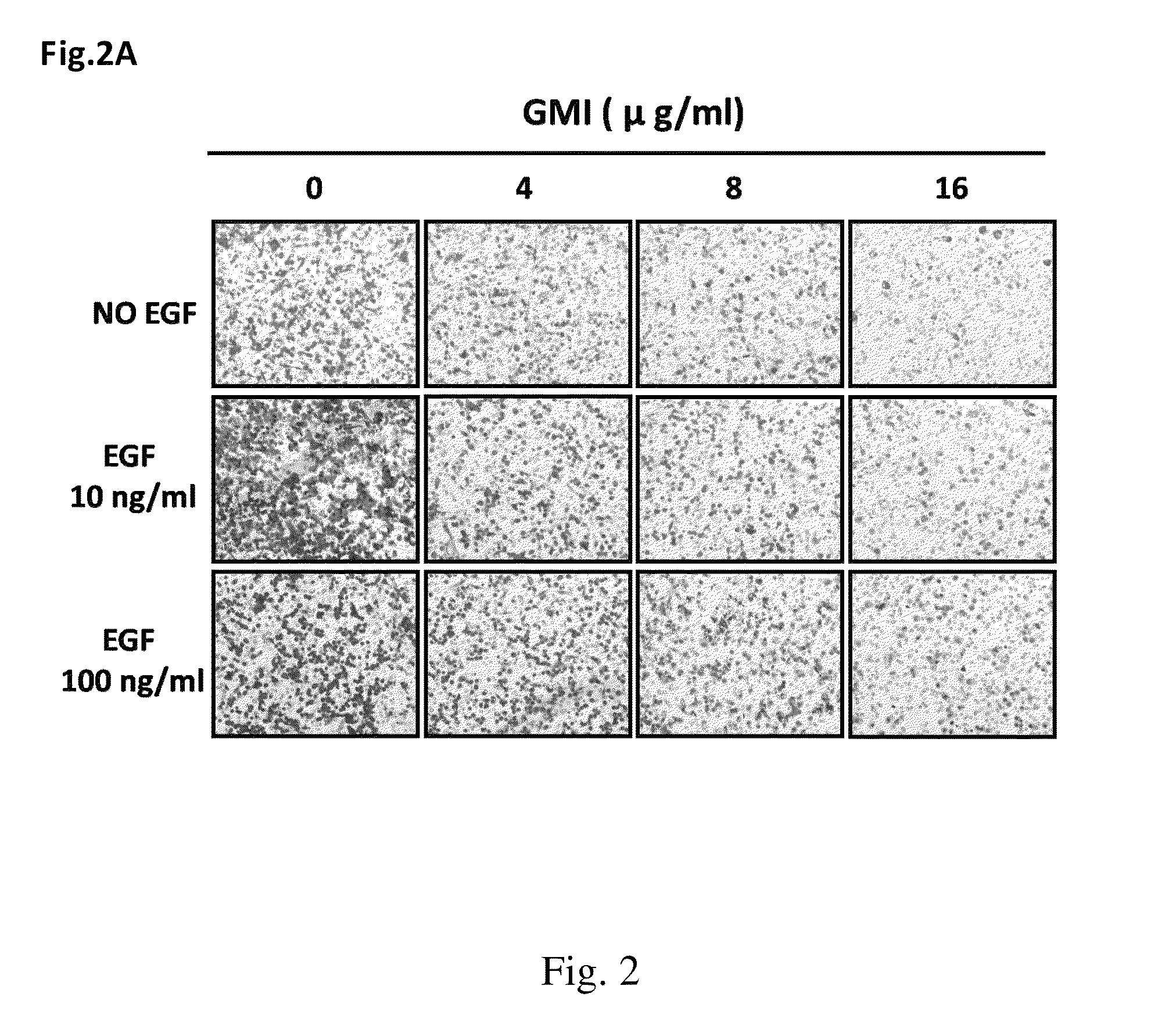 Uses of an immunomodulatory protein (GMI) from Ganoderma microsporum