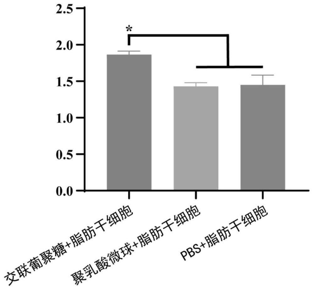 Face filling agent containing cross-linked glucan and preparation method thereof