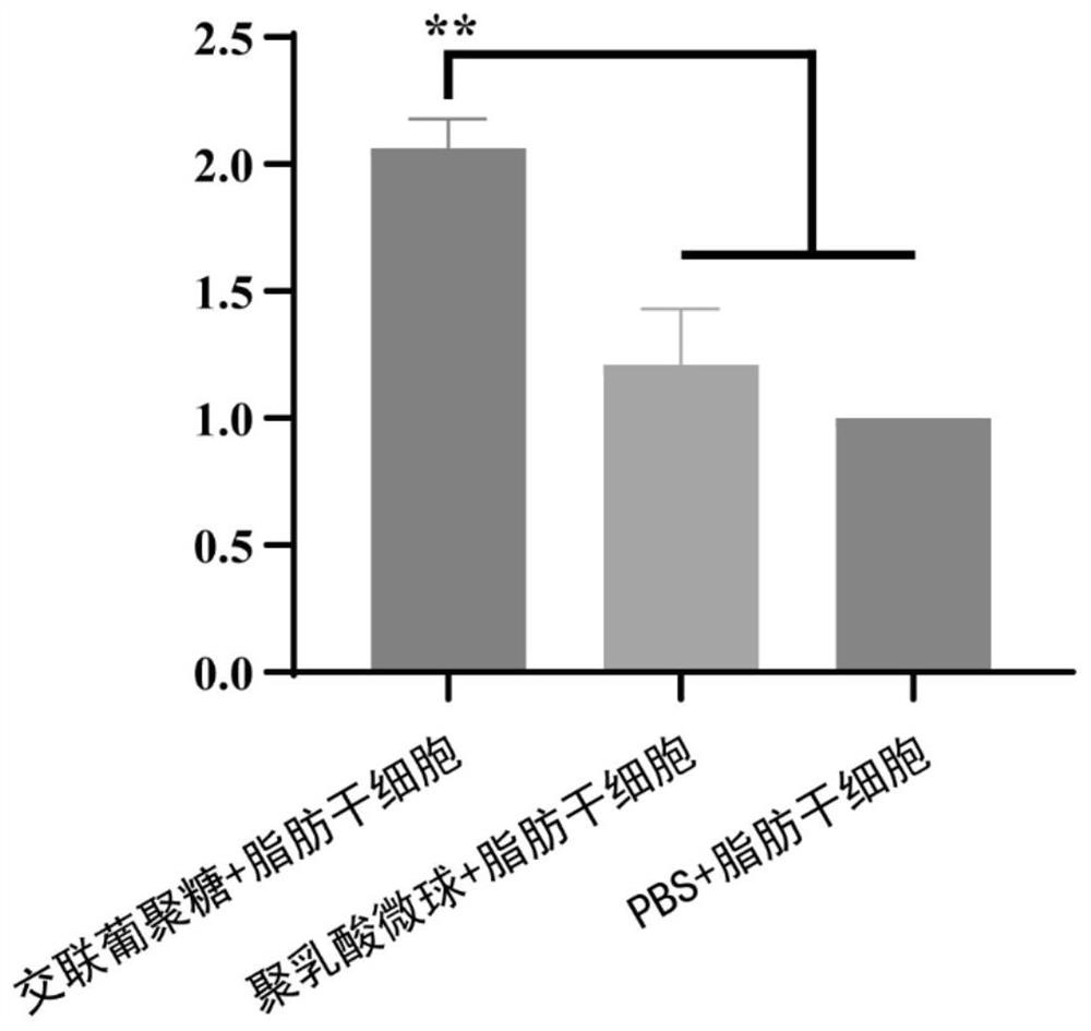 Face filling agent containing cross-linked glucan and preparation method thereof