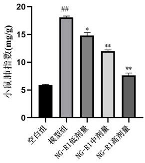 New application of notoginsenoside R1