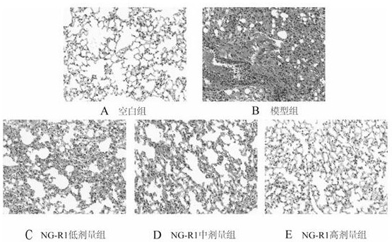 New application of notoginsenoside R1