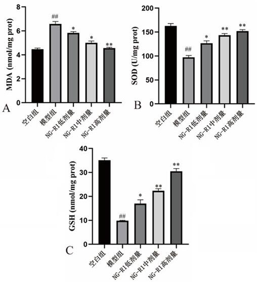 New application of notoginsenoside R1