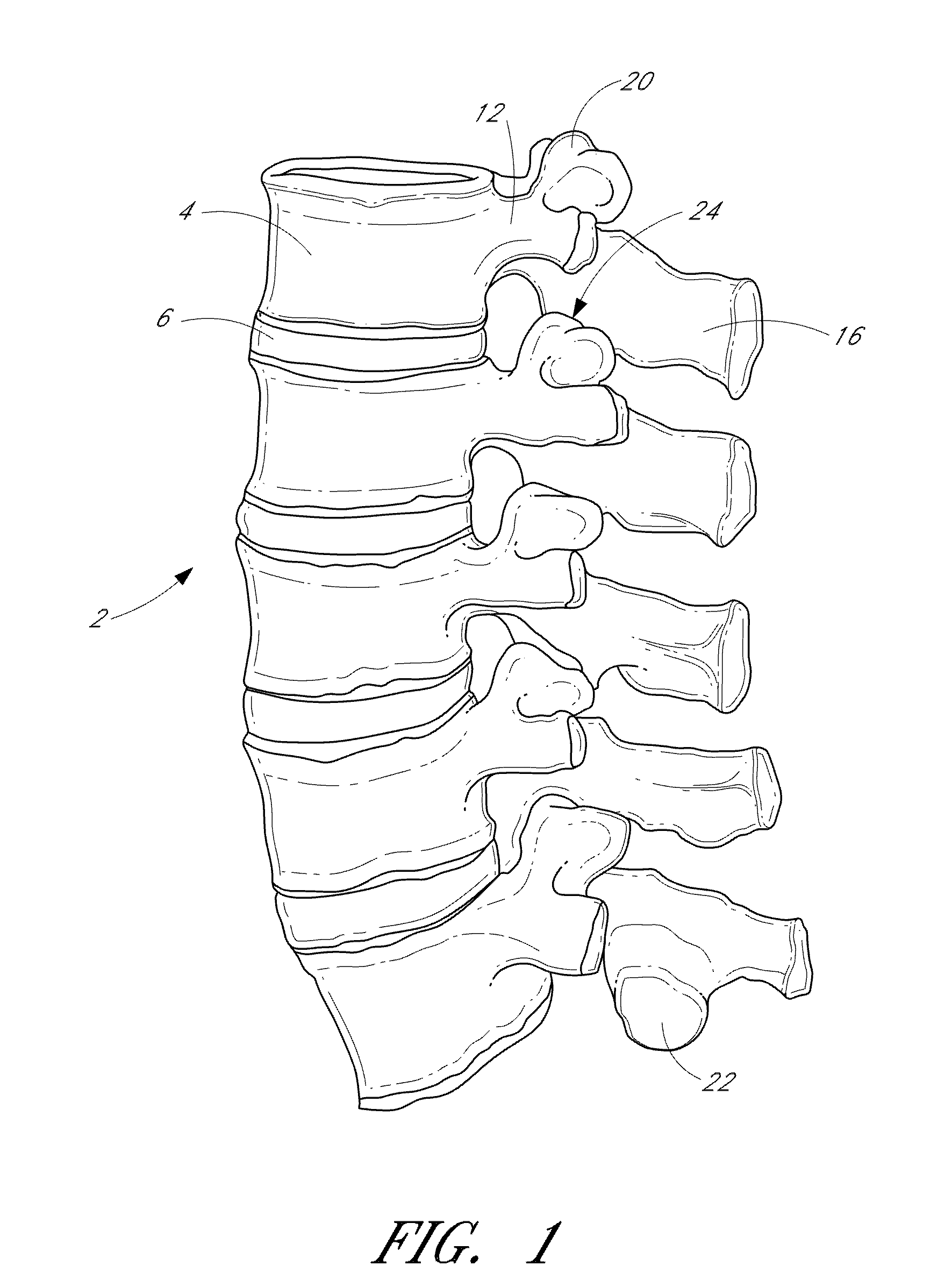 Flanged interbody fusion device
