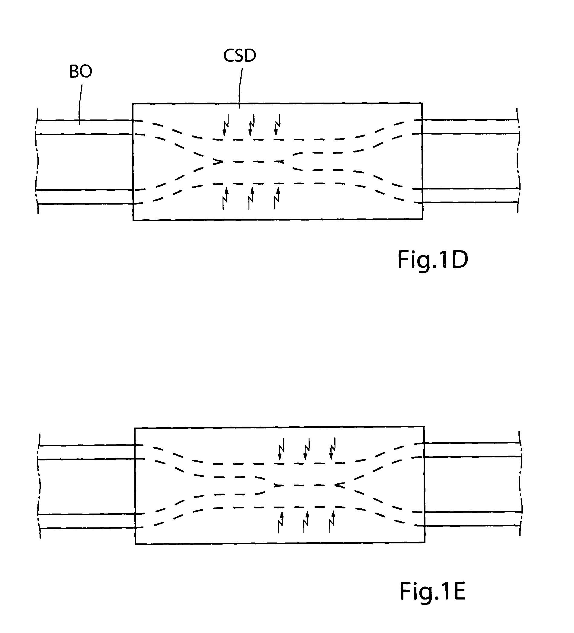 Method for controlling flow of intestinal contents in a patient's intestines
