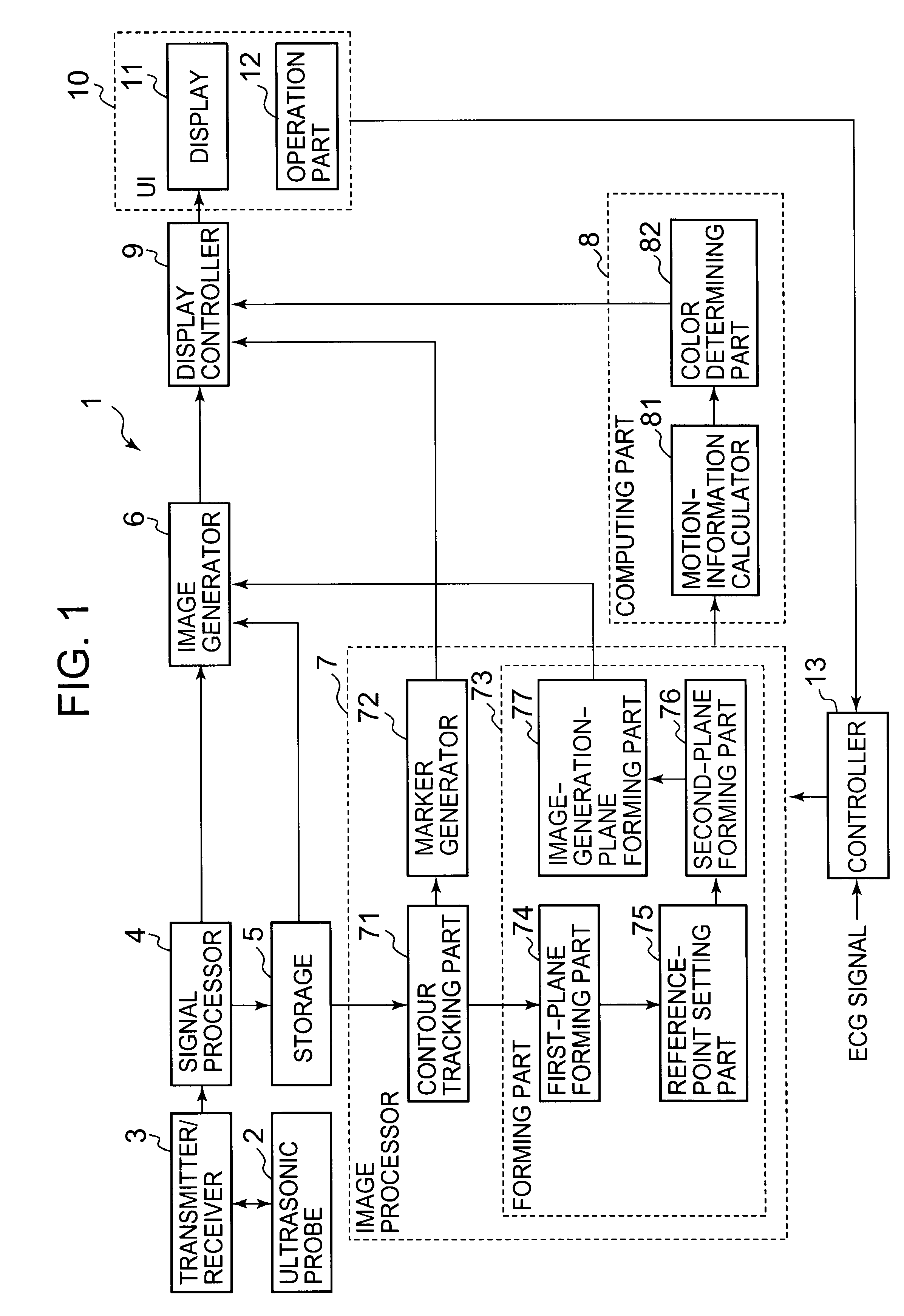 Ultrasonic image processing apparatus and a method for processing an ultrasonic image