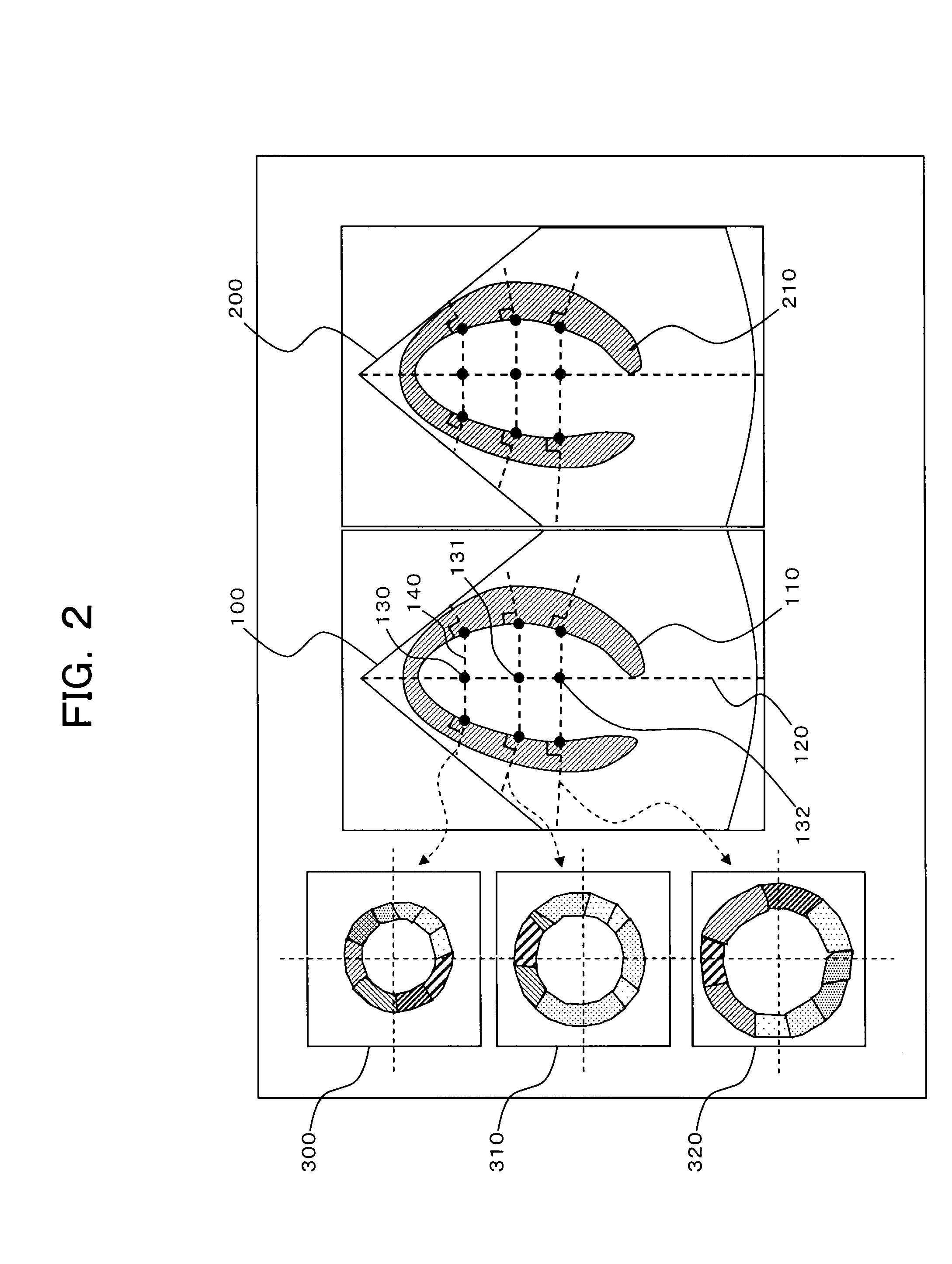 Ultrasonic image processing apparatus and a method for processing an ultrasonic image