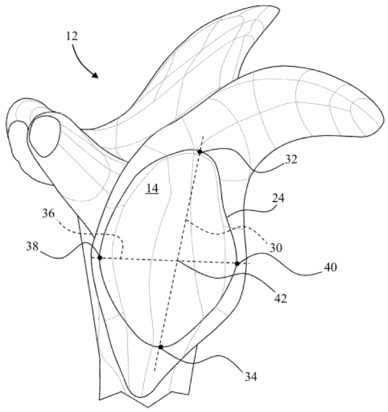 Device and method for retroversion correction for shoulder arthroplasty