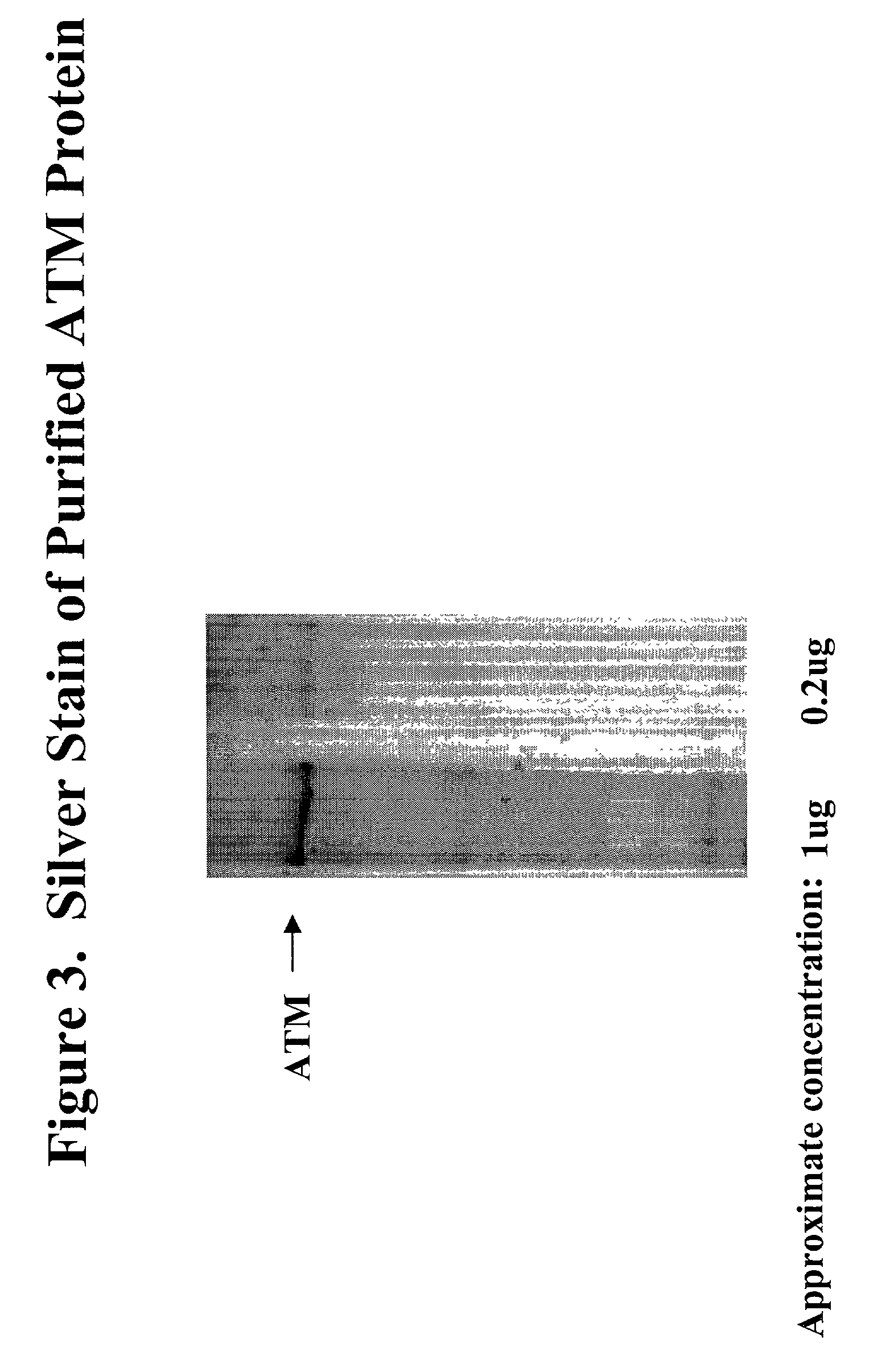 Expression and purification of ATM protein using vaccinia virus
