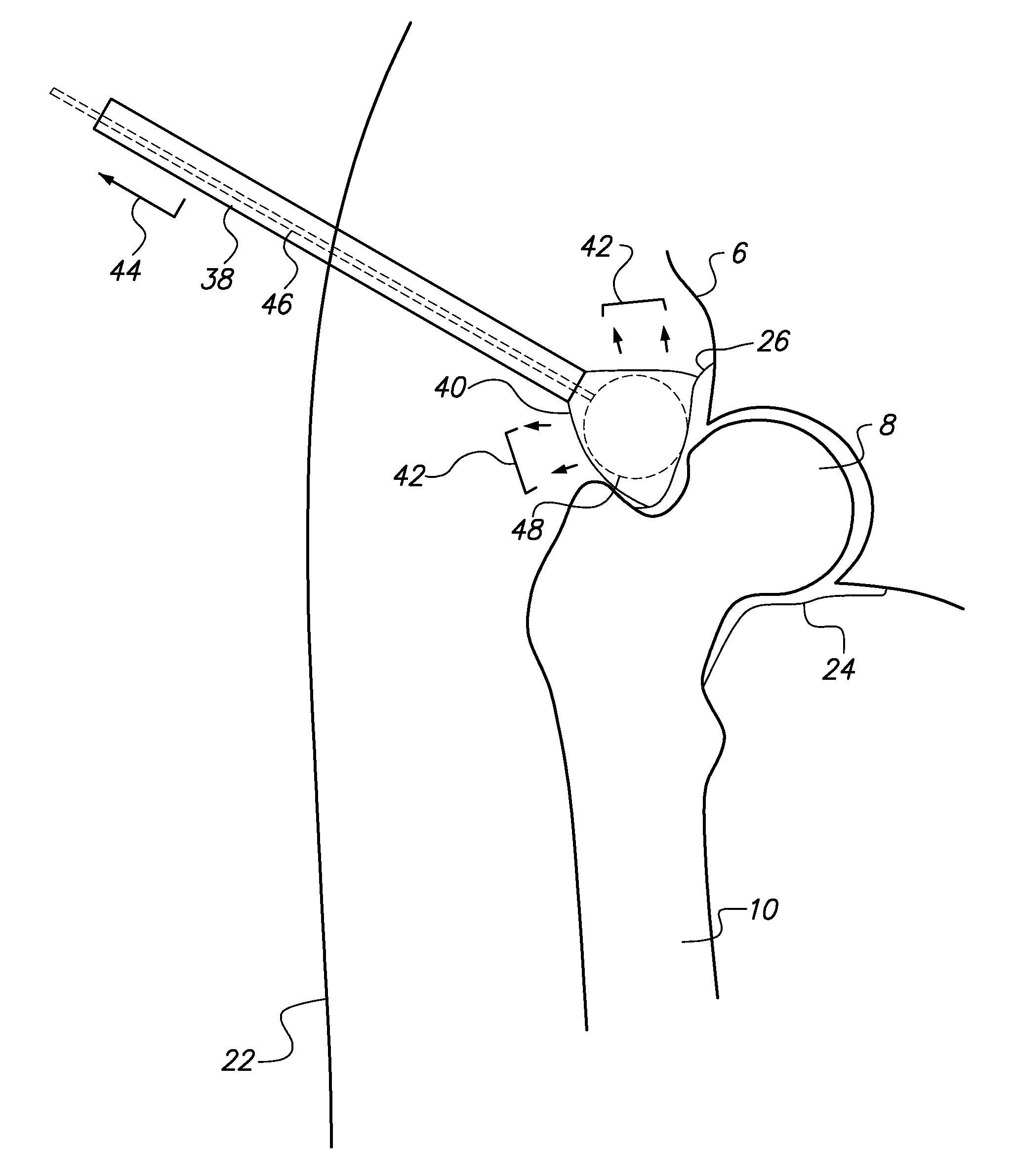 System and method for image-guided arthroscopy