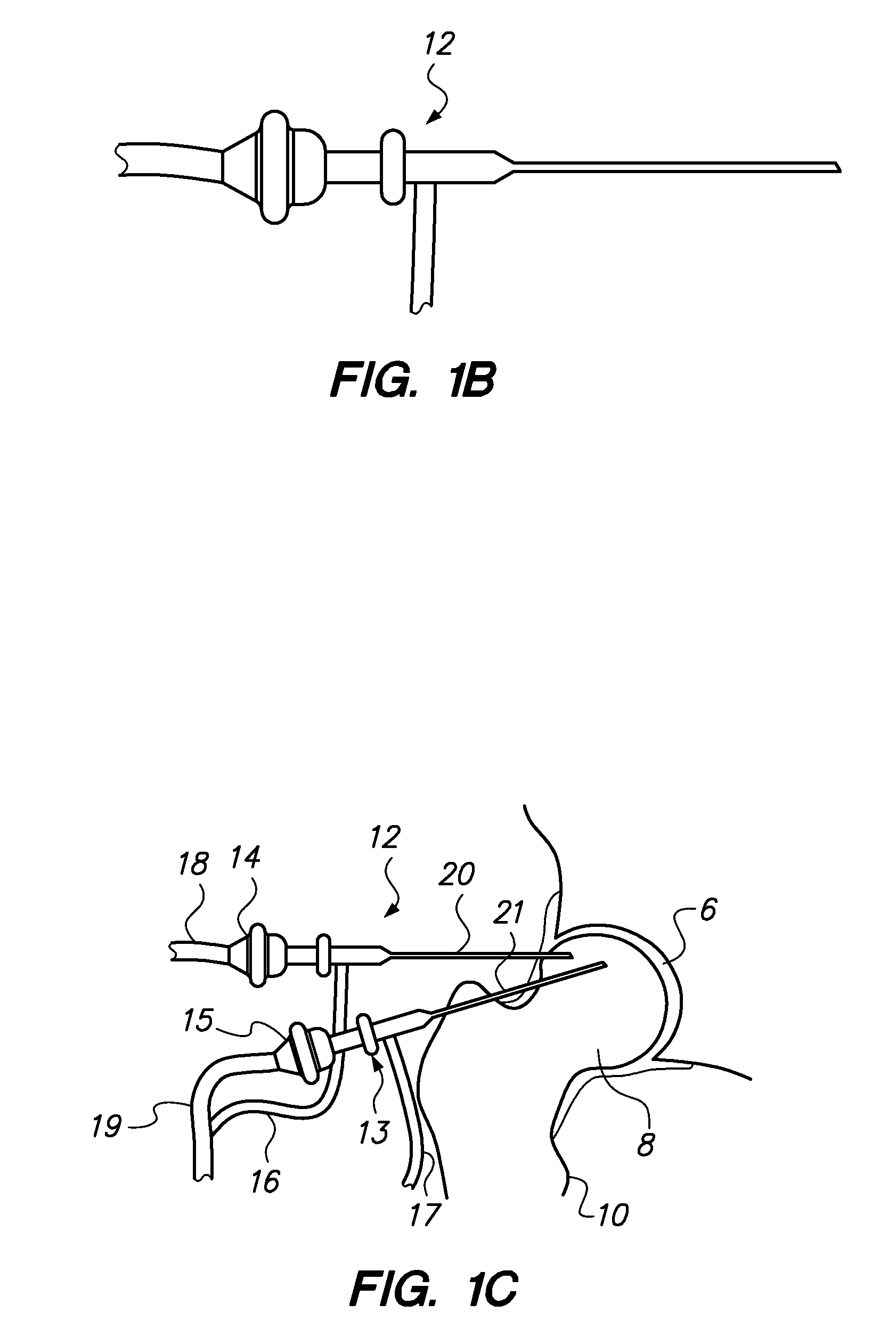 System and method for image-guided arthroscopy
