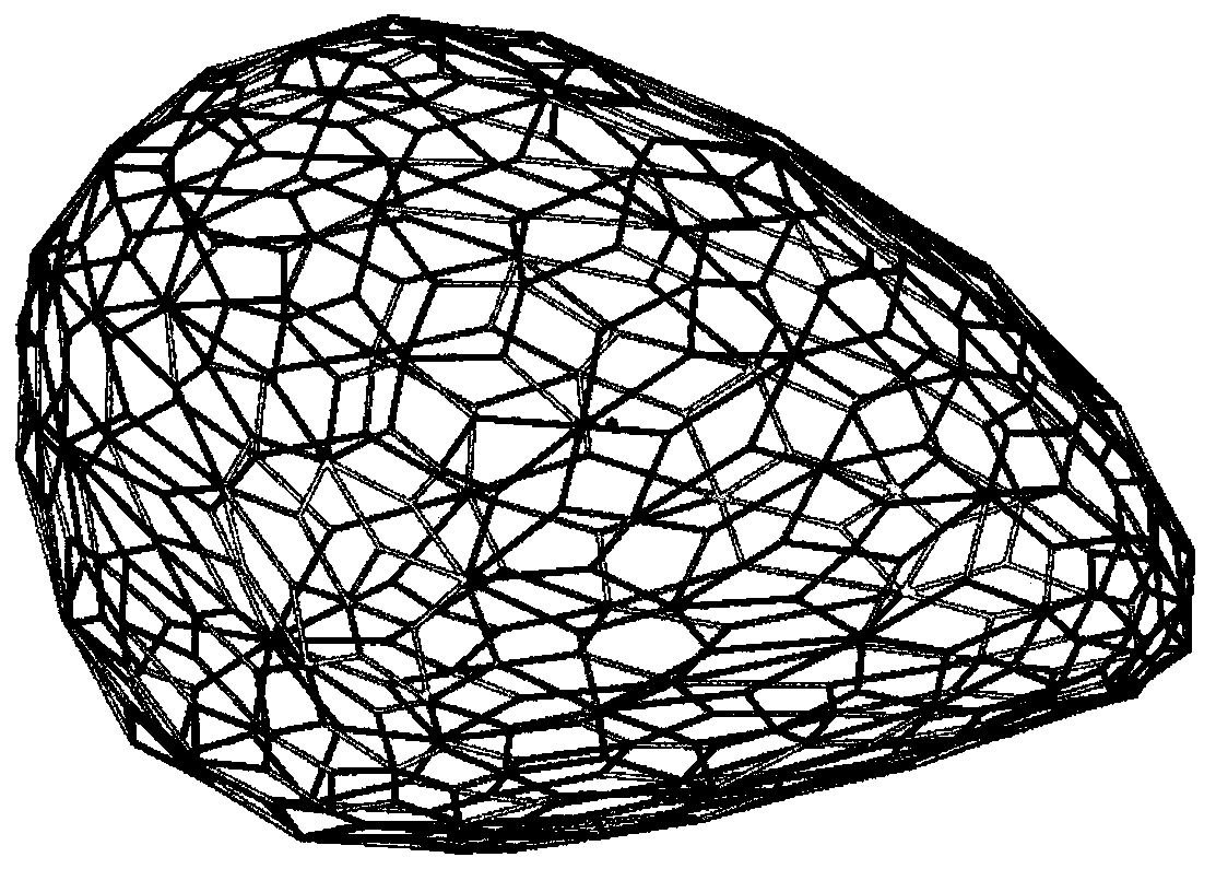 A degradable gradient pore mammary gland scaffold