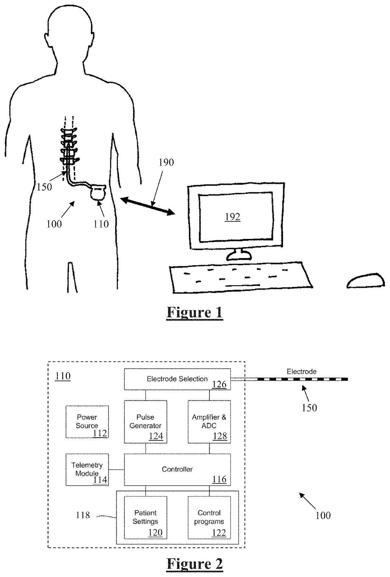 Neural Stimulation Dosing