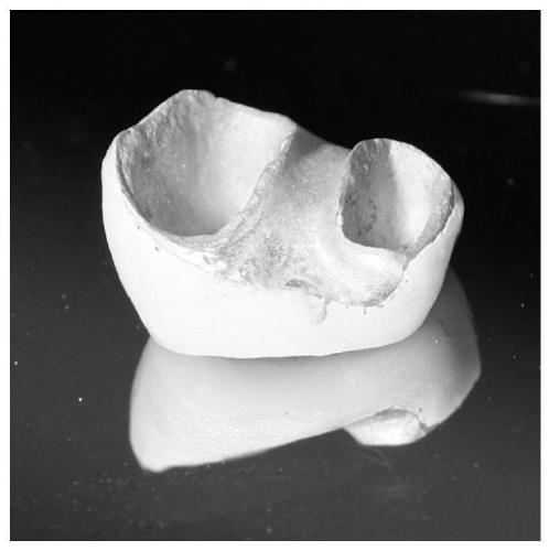 Artificial crown for maxillary molar