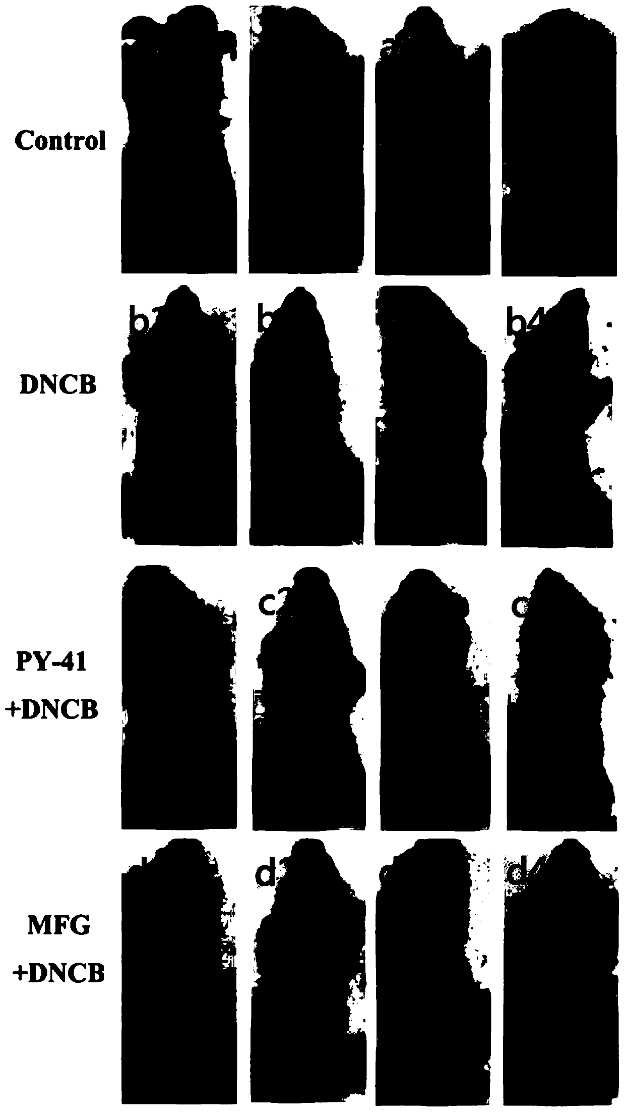 Application of pyrazolidinyl compounds in preparation of preparations used for treating dermatitis