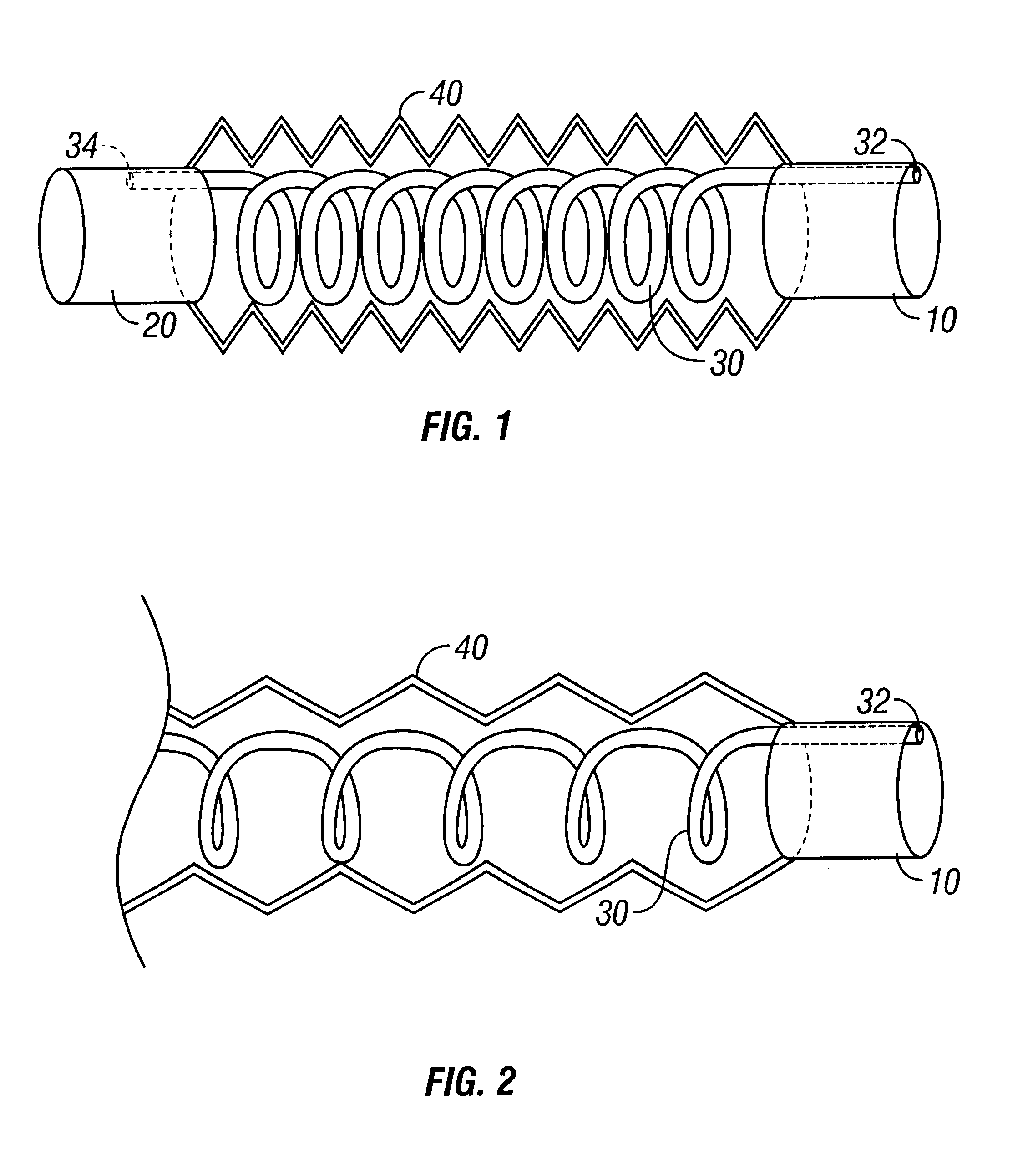Breathing circuits having unconventional respiratory conduits and systems and methods for optimizing utilization of fresh gases