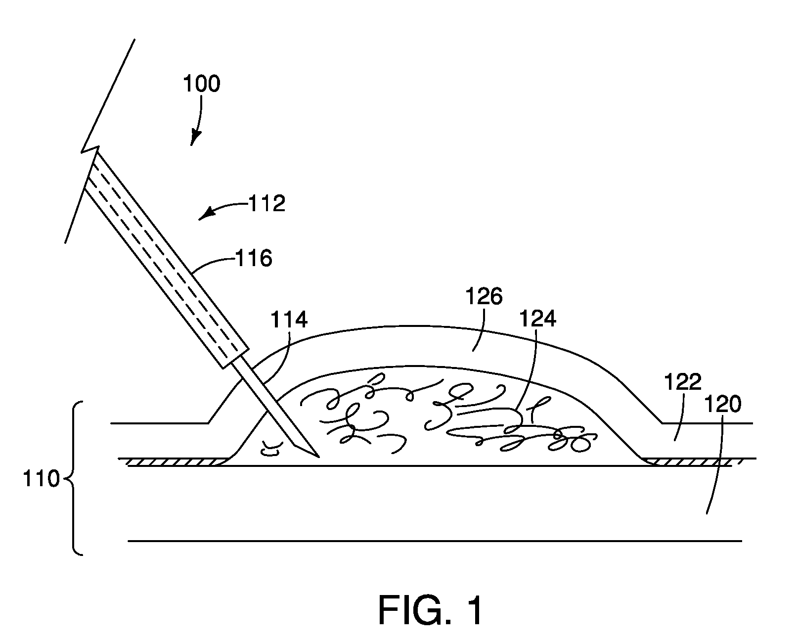 Apparatus and Method for Endoscopic Submucosal Dissection