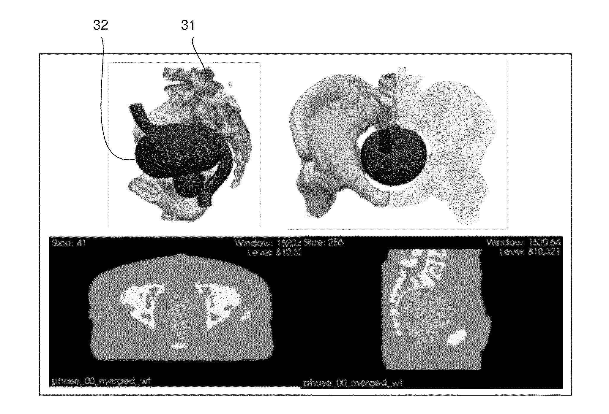 Method of Evaluating a Procedure for Determining the Aggregate Dose Received in the Course of a Radiotherapy Treatment