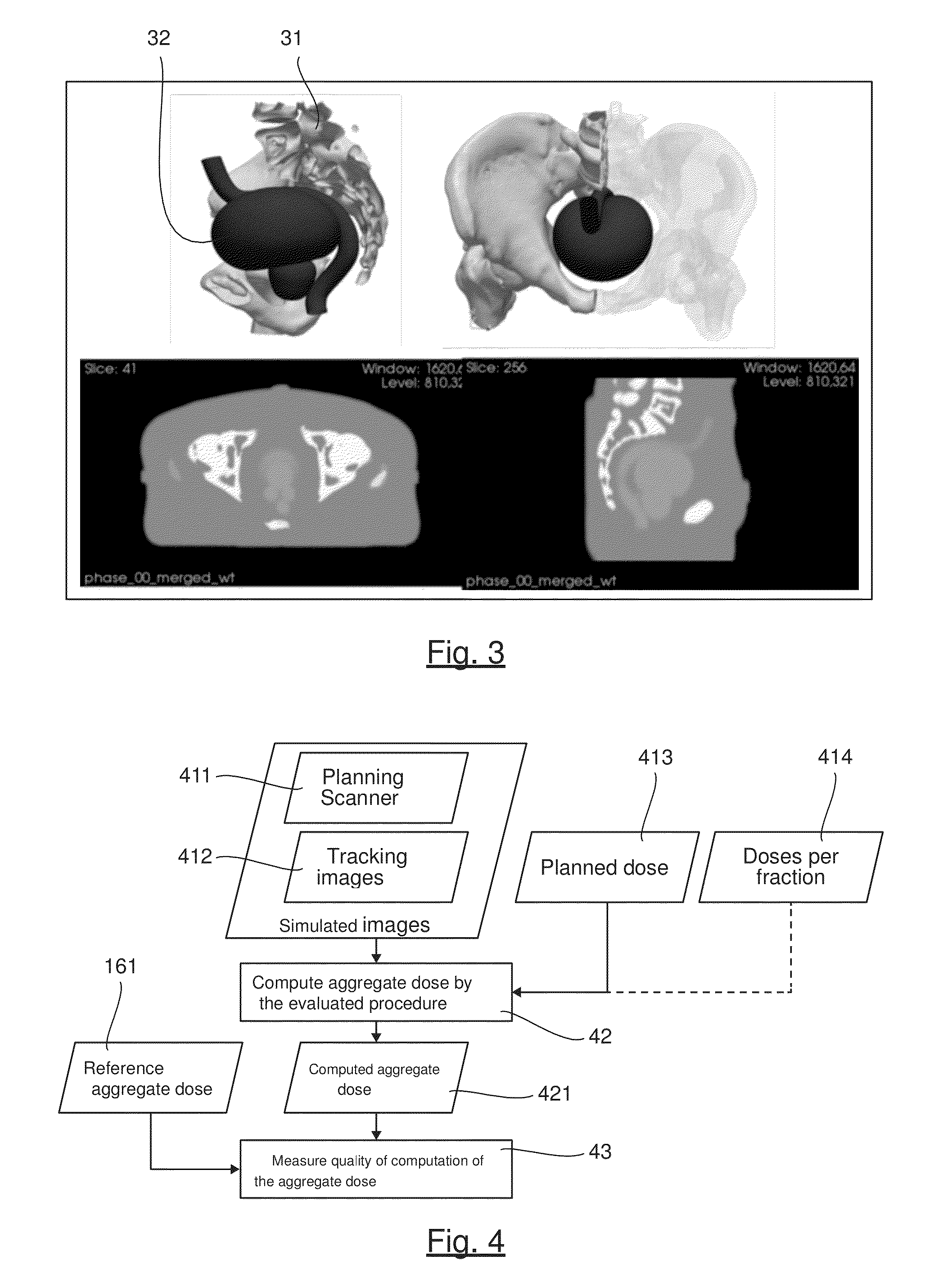 Method of Evaluating a Procedure for Determining the Aggregate Dose Received in the Course of a Radiotherapy Treatment