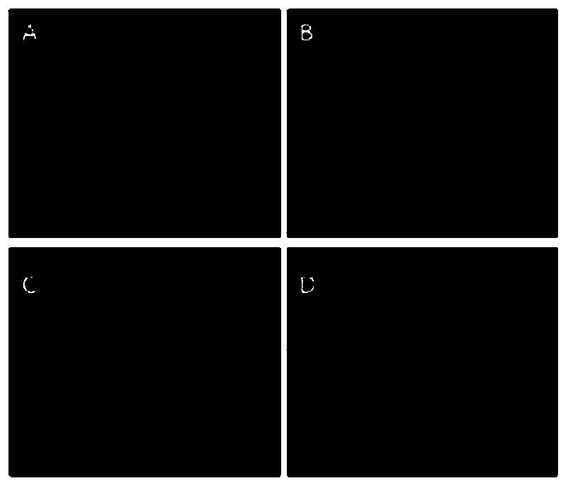 A method for non-invasive detection of ultraviolet light-induced skin damage in vivo and its detection equipment