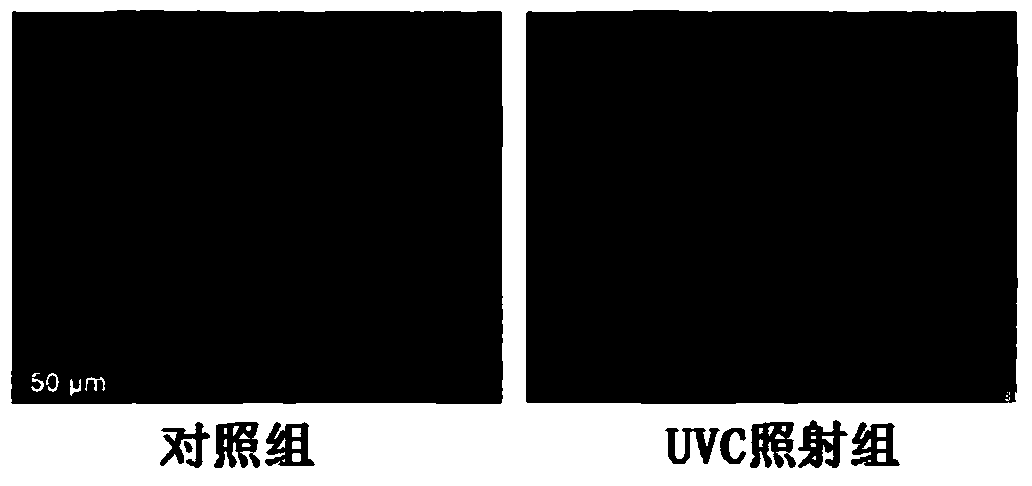 A method for non-invasive detection of ultraviolet light-induced skin damage in vivo and its detection equipment