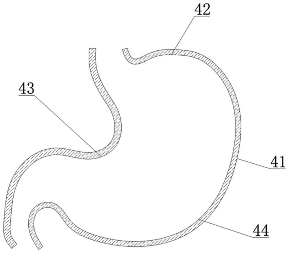 Gastroscopy system and method for digestive system department based on Internet of Things