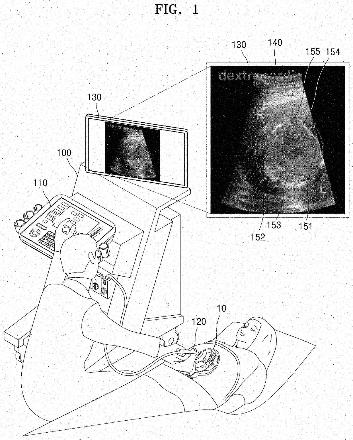 Ultrasound diagnosis apparatus for determining abnormality of fetal heart, and operating method thereof