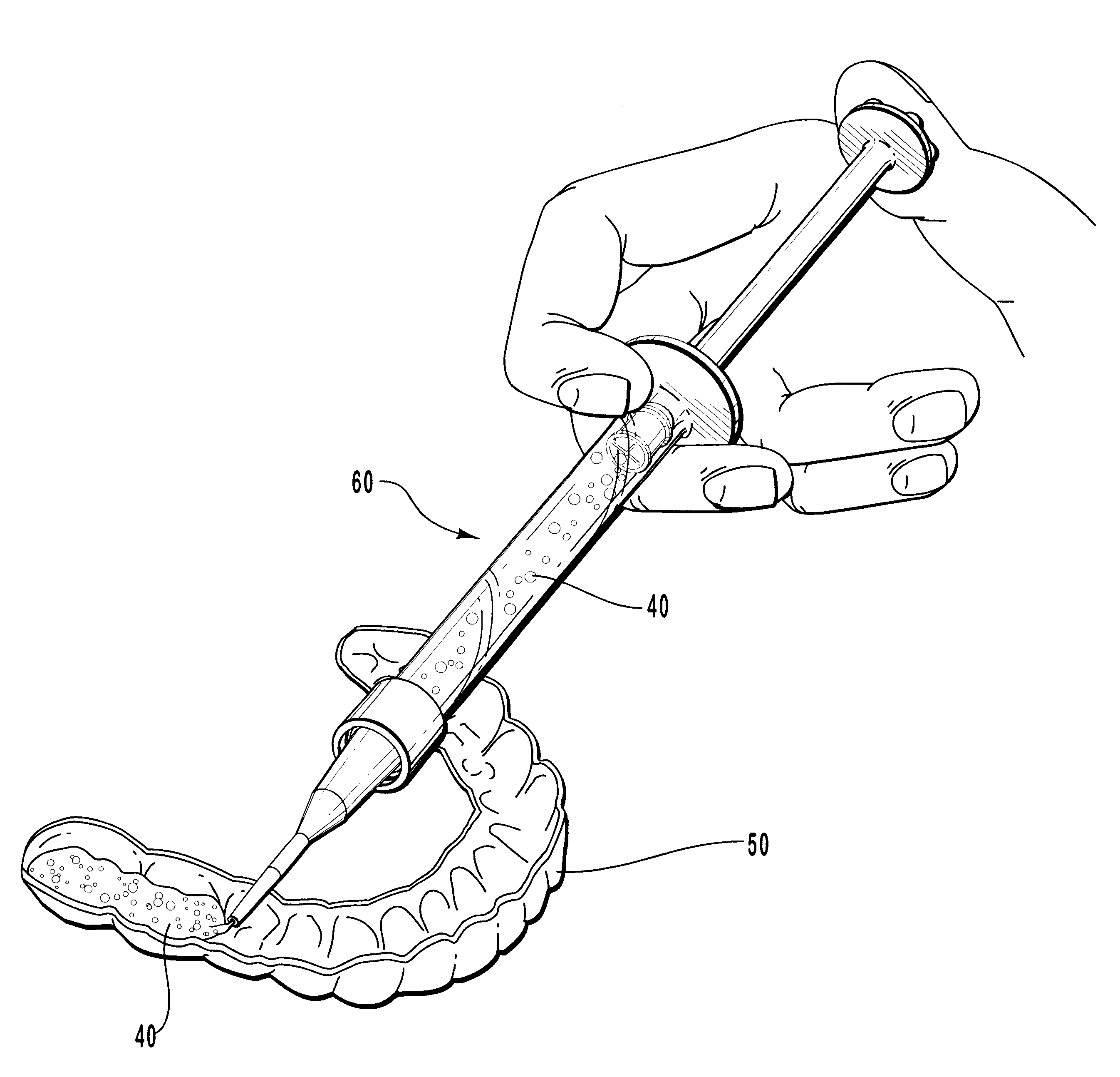 Compositions and methods for whitening and desensitizing teeth