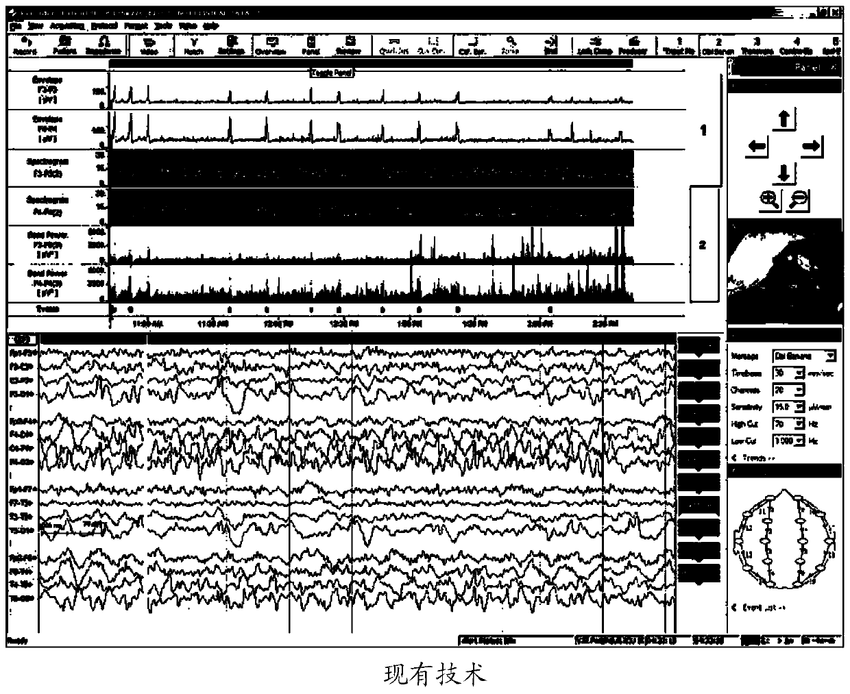 Electroencephalogram time frequency information visualizing method