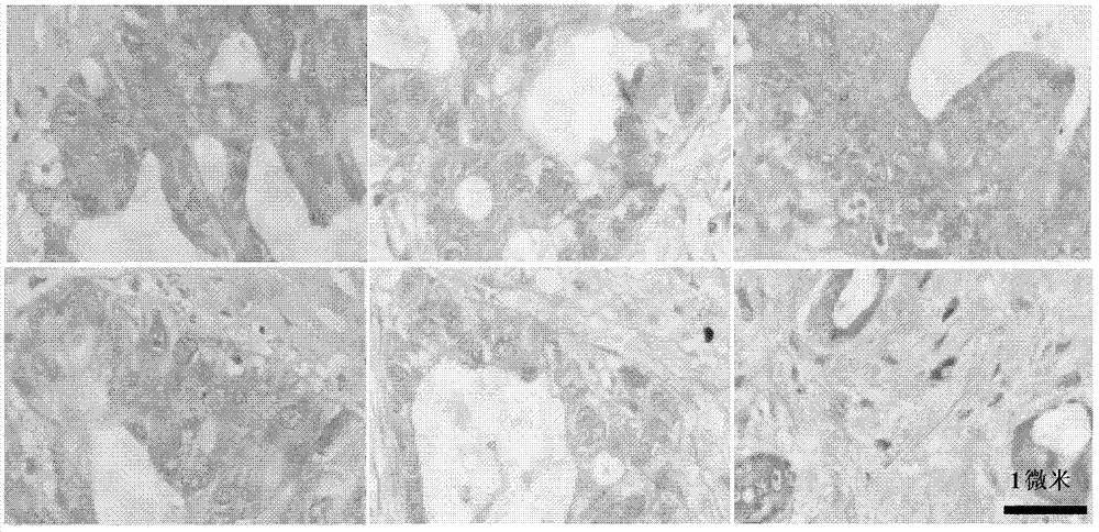 Application of BRSK2 in preparation of reagents for diagnosing pancreatic cancer