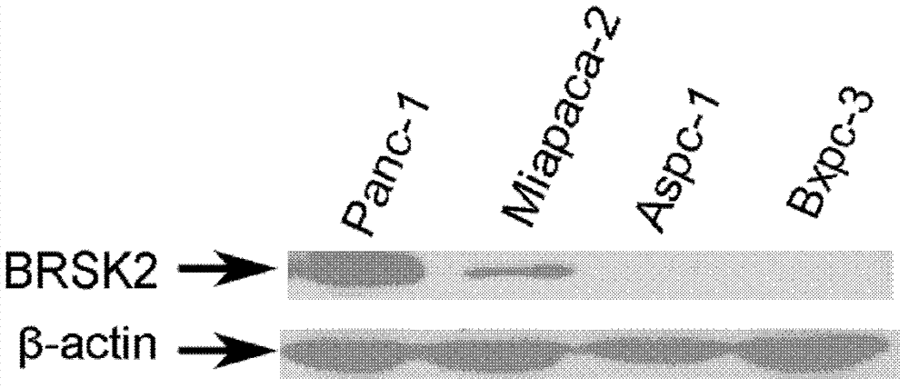 Application of BRSK2 in preparation of reagents for diagnosing pancreatic cancer