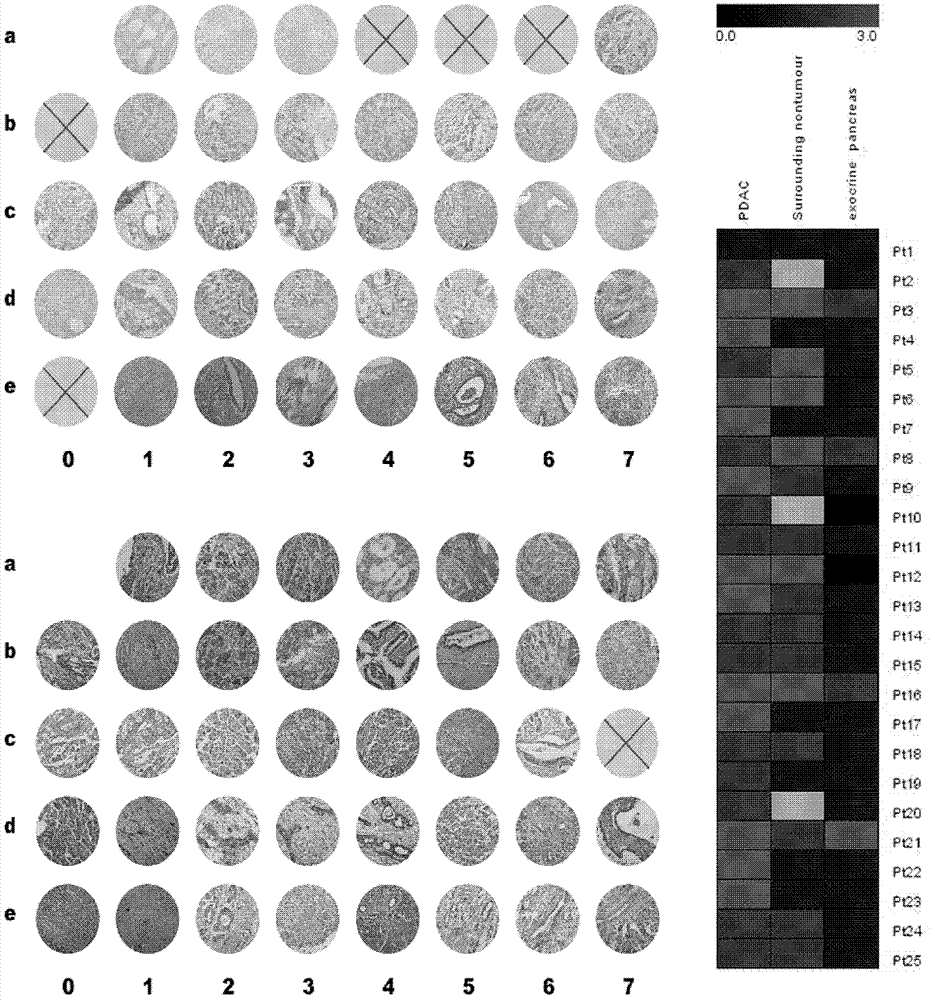 Application of BRSK2 in preparation of reagents for diagnosing pancreatic cancer