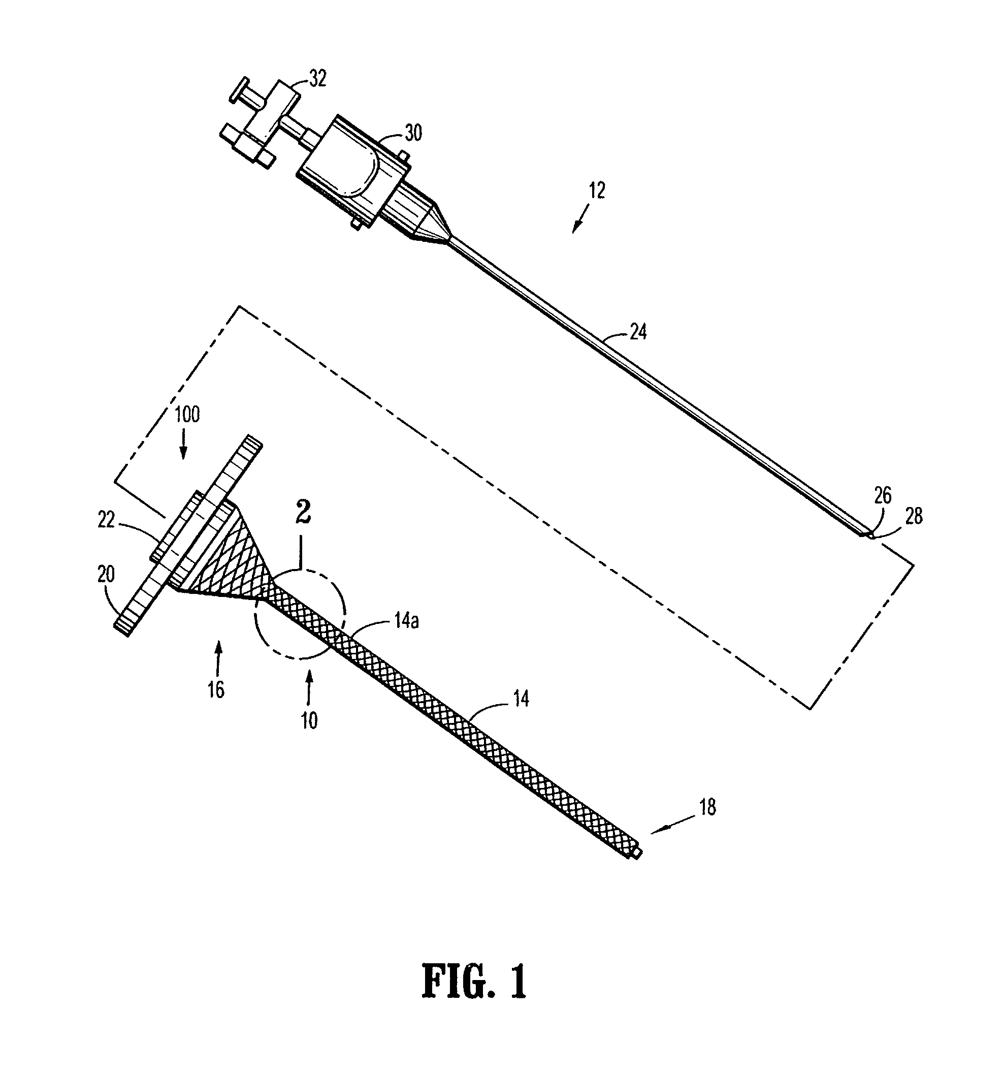 Wound Closure Device Including Suction Step Sleeve