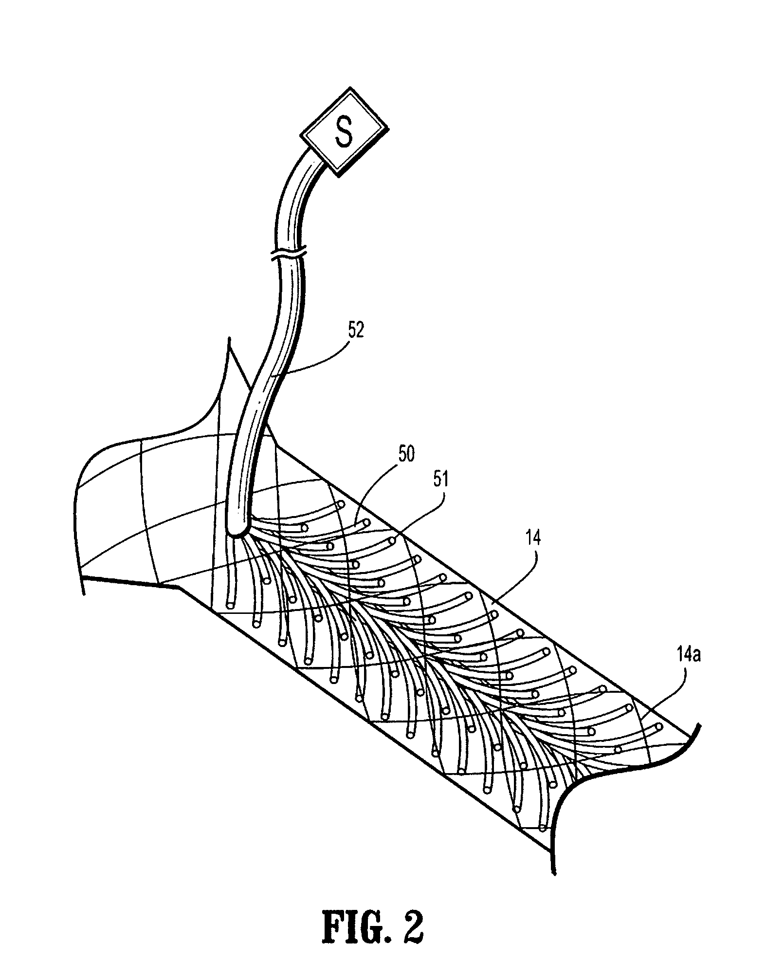 Wound Closure Device Including Suction Step Sleeve