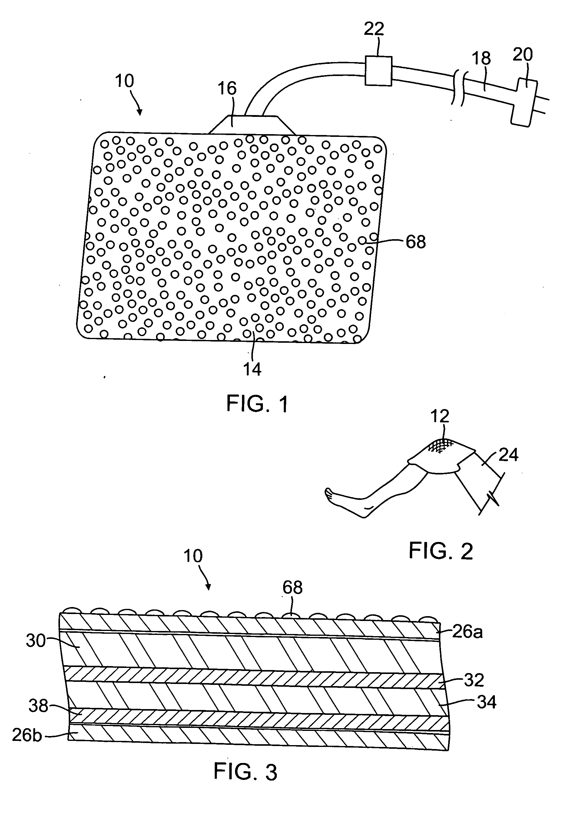 Radiant heating apparatus and method for therapeutic heating