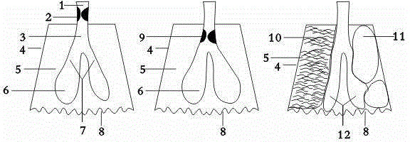 Model for demonstrating pulmonary ventilation disfunction